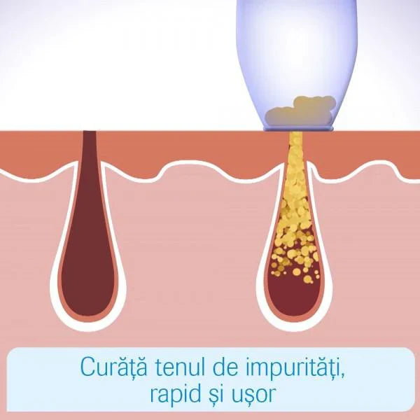 Aspirator de Curatare Faciala