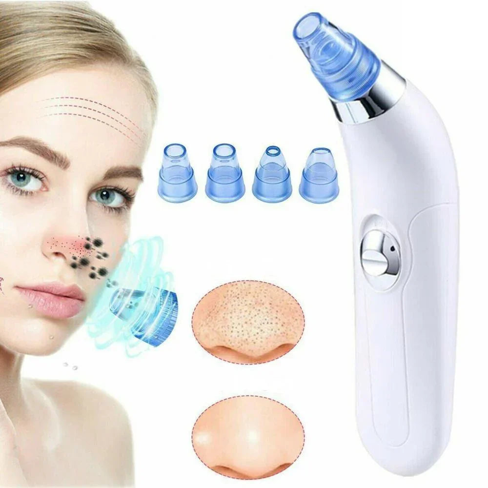 Aspirator de Curatare Faciala